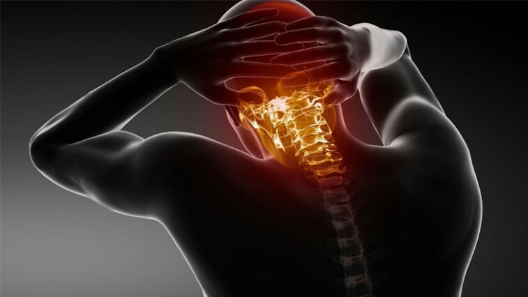 pijn in de achterkant van het hoofd met cervicale osteochondrose